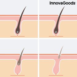 IPL hrfjerner innovagoods 
