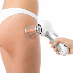 massageapparat mod appelsinhud i brug p� hud med vakuum massage